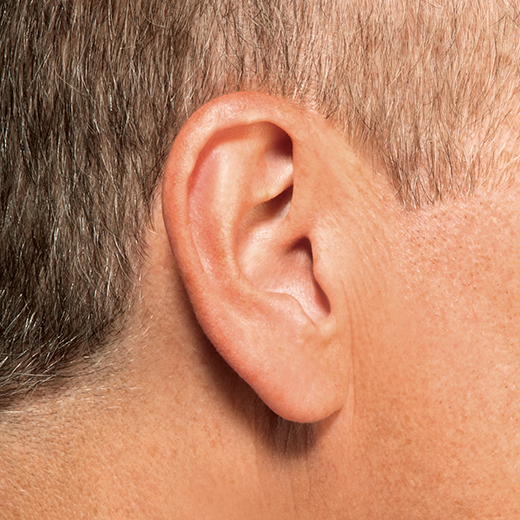 Invisible hearing aid in ear